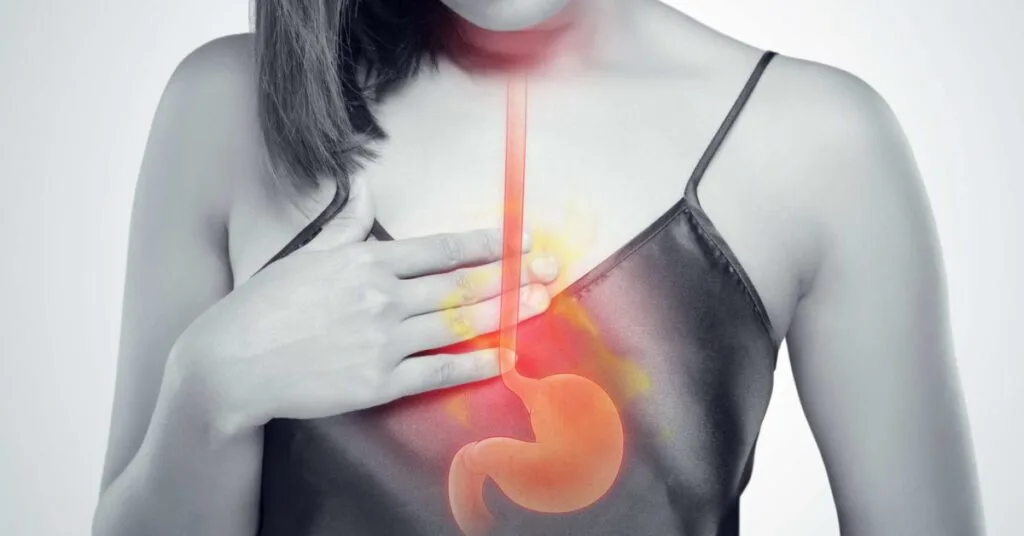 Barrett's Esophagus: Symptoms, Causes, Signs, Treatment