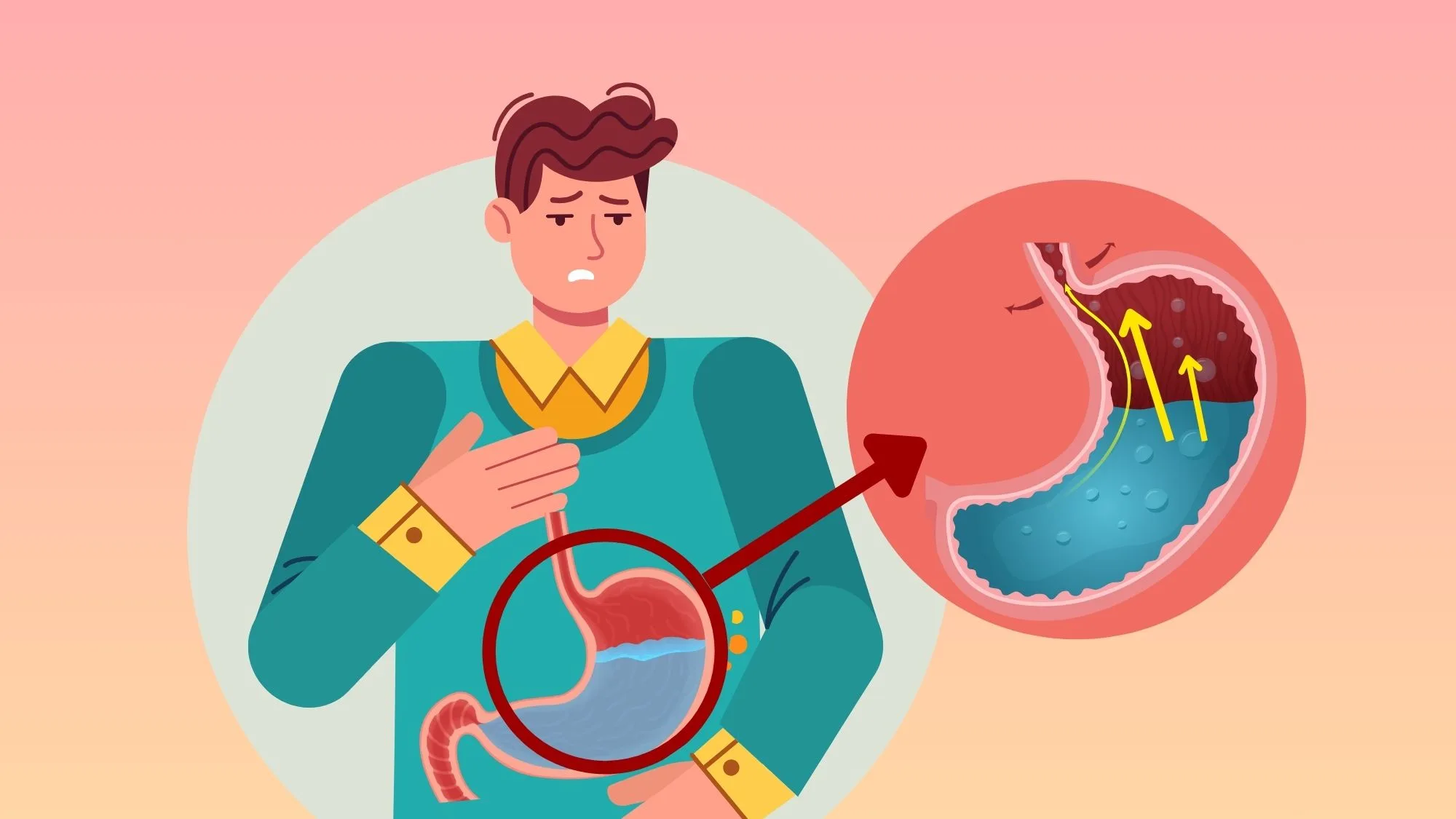 Acid Reflux Fatality: Can GERD Kill You in Sleep?